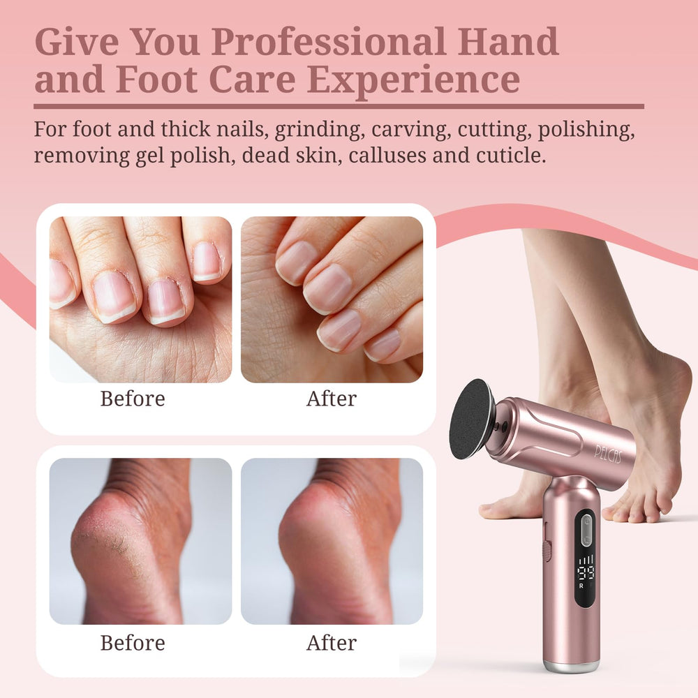 Pelcas tête pédicure-ongles pour limer et polir avec précision