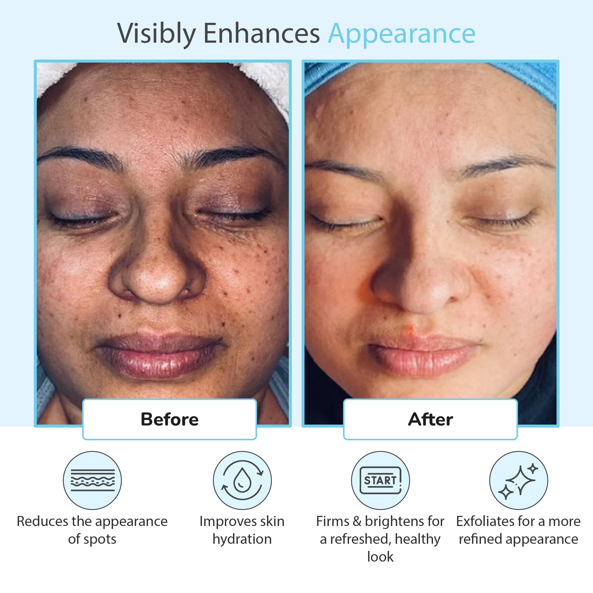 Retinol et extrait de thé vert dans le Perfect Image peeling glycolique 50% pour revitaliser.