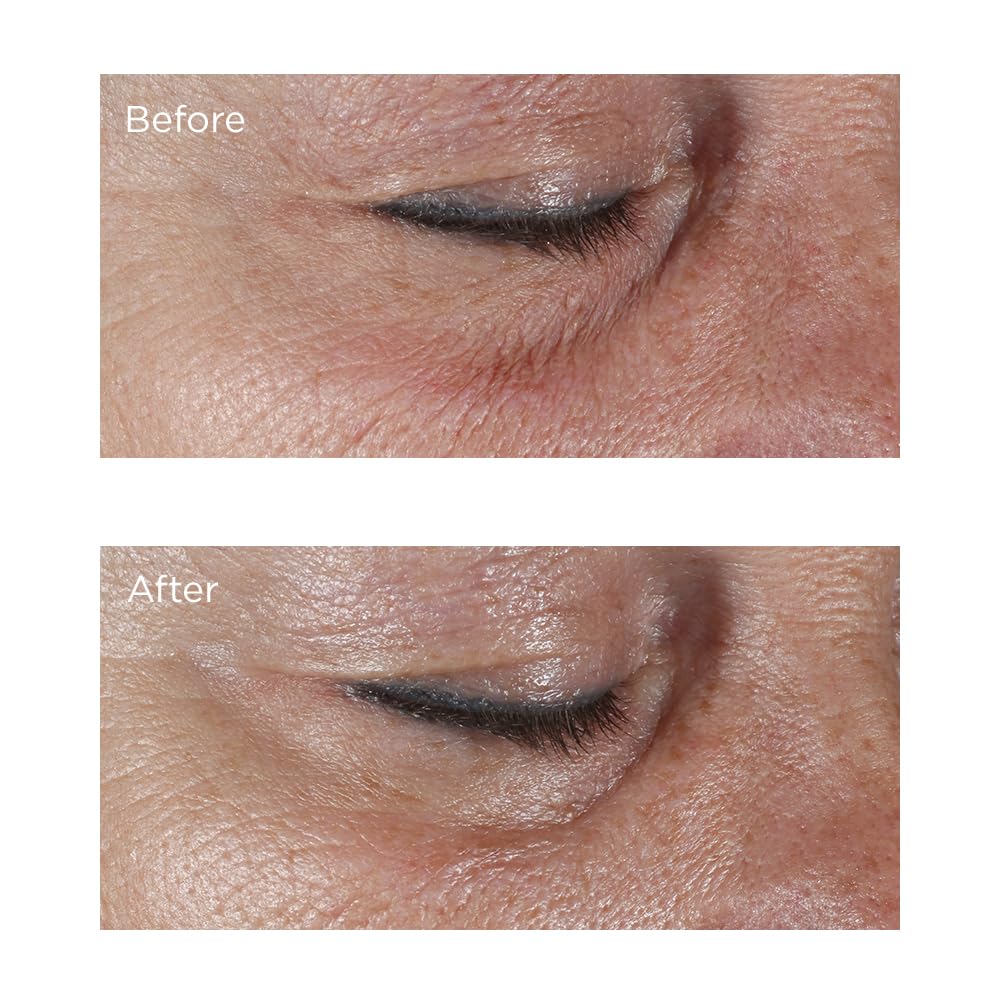 Perricone MD Application Contour Yeux Quotidien pour hydratation durable