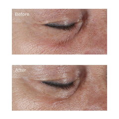 Perricone MD Application Contour Yeux Quotidien pour hydratation durable