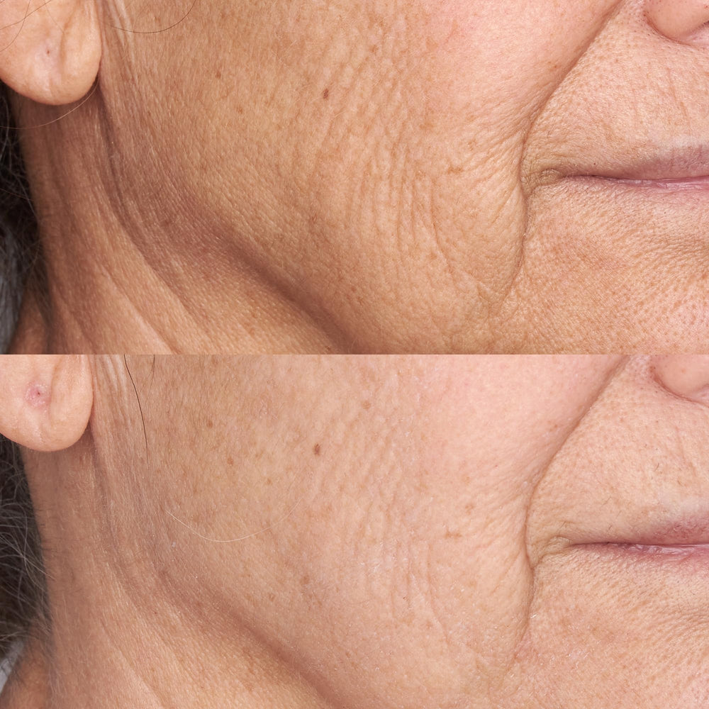 Perricone MD application rapide – creme visage qui pénètre rapidement.