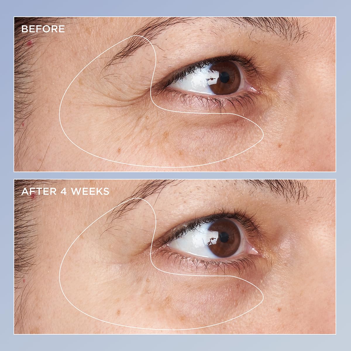 Perricone MD Béta-carotène – soutien anti-lumière pour le regard