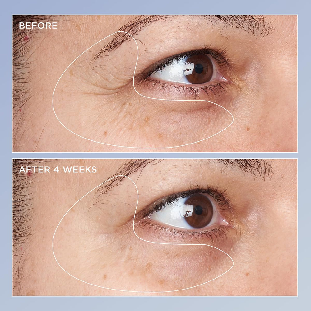 Perricone MD Béta-carotène – soutien anti-lumière pour le regard