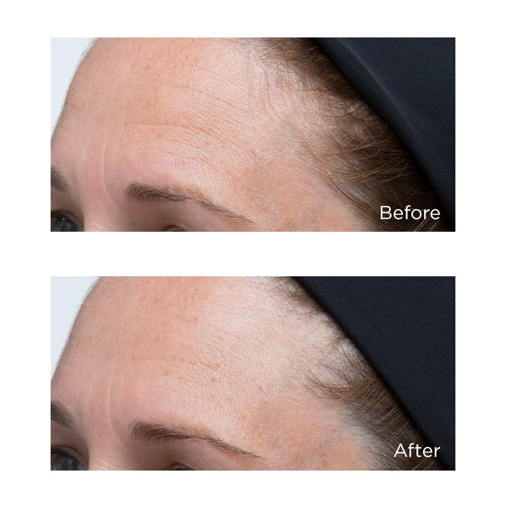 Application rapide et nourrissante par Perricone MD Hydratant Intensif.