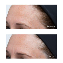 Application rapide et nourrissante par Perricone MD Hydratant Intensif.