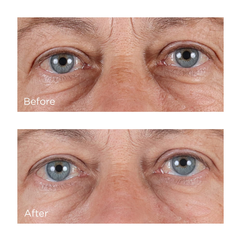 Absorption rapide du Sérum Hyaluronique Perricone MD, fini léger.