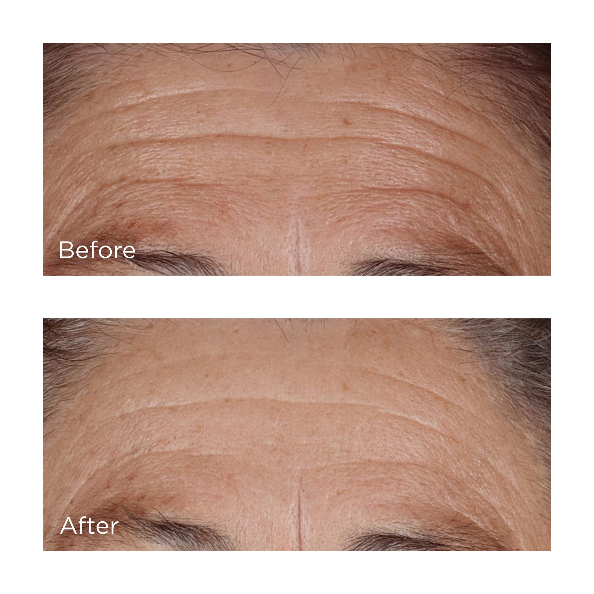 Complexe 4 formes d'hyaluronique pour hydratation multi-niveaux Perricone MD.