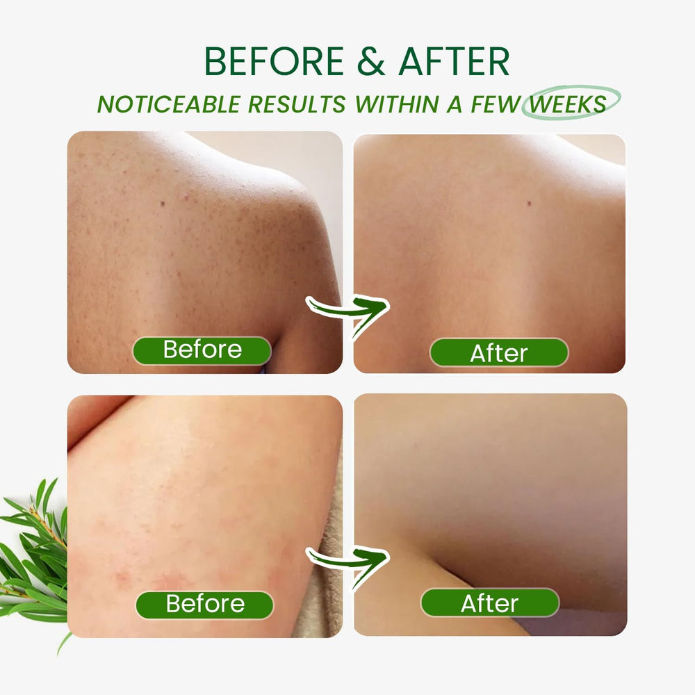 PHARMBANNER Tea Tree Body Wash, formule naturelle: adaptée peau sensible et usage quotidien.