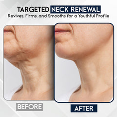 Pharmlitalia crème-visage-cou raffermissement: peau plus ferme et lisse.