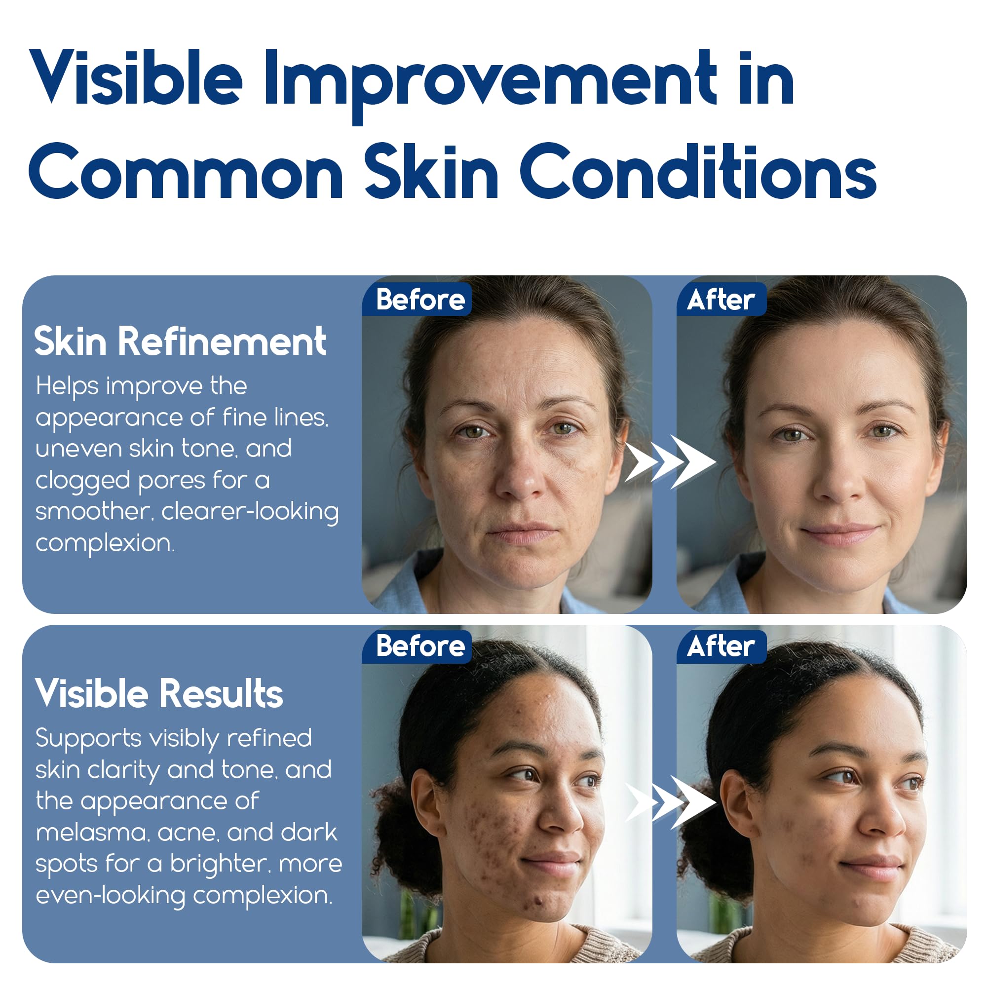 Pharmlitalia cotons exfoliants – teint visiblement plus uniforme sur le visage.