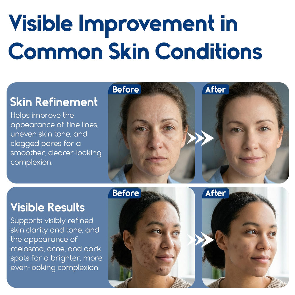 Pharmlitalia cotons exfoliants – teint visiblement plus uniforme sur le visage.