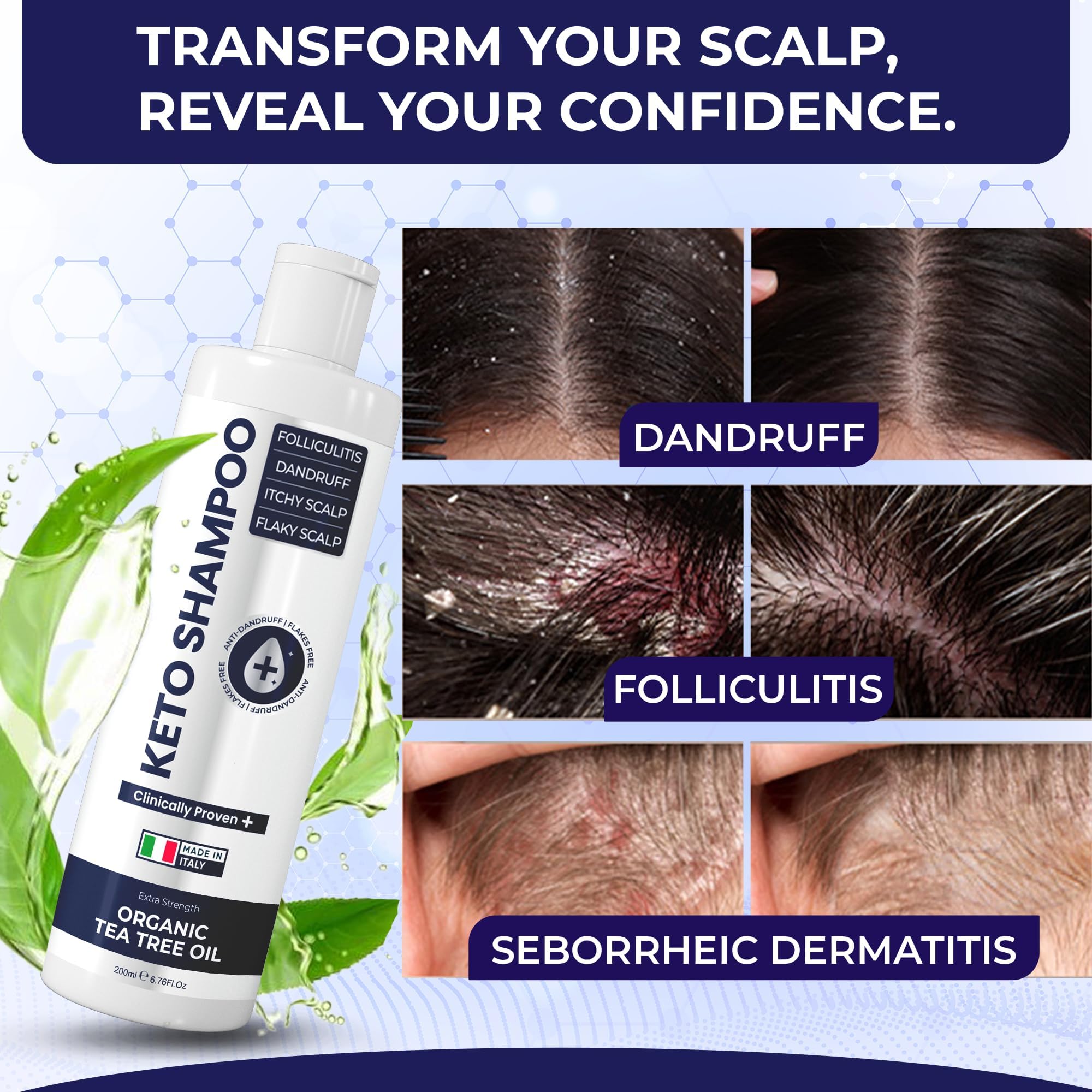 Shampooing Pharmlitalia texture-mousse – expérience lavante agréable et cheveux propres.