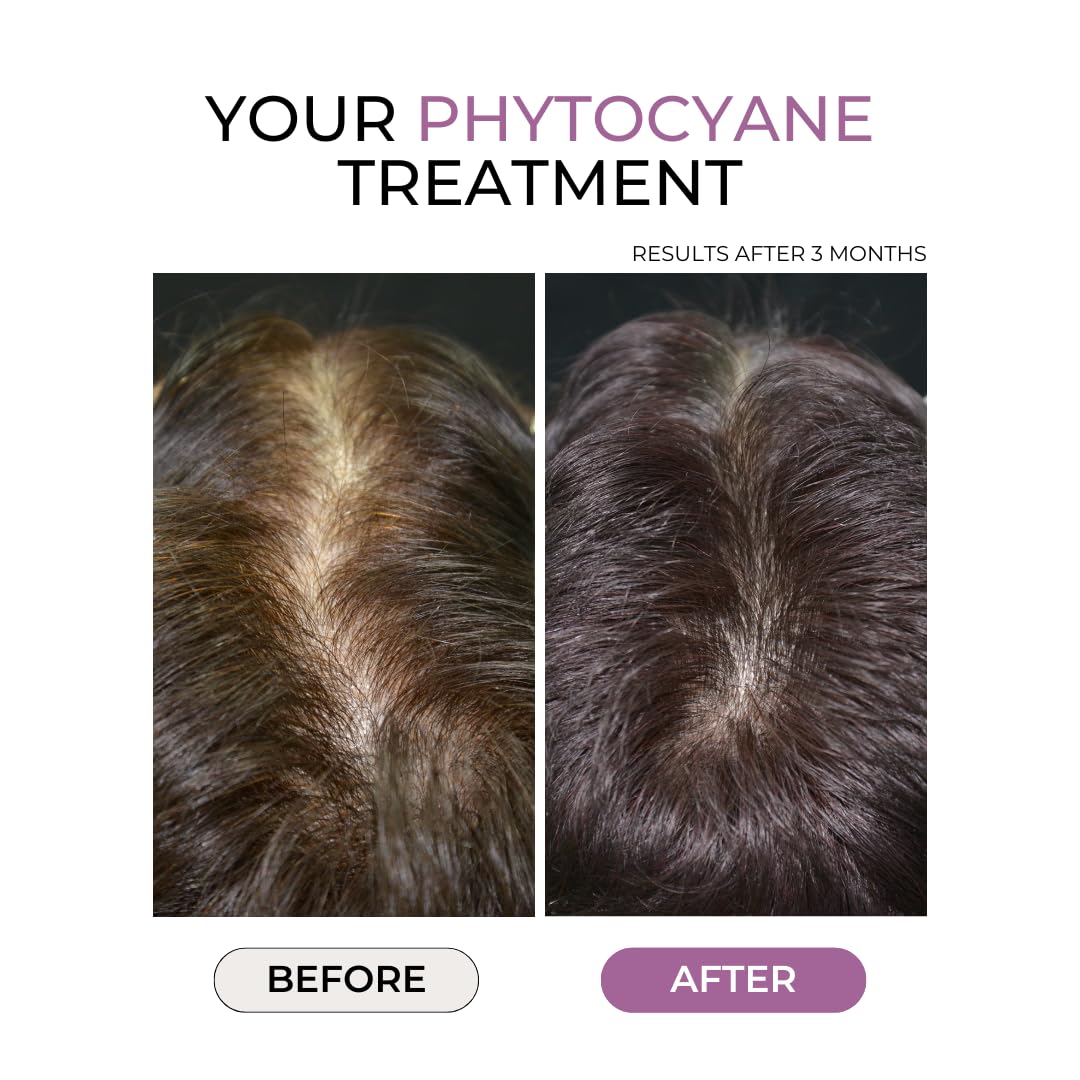 PHYTOCYANE capsules prêtes à être consommées avec un verre d’eau quotidiennement.