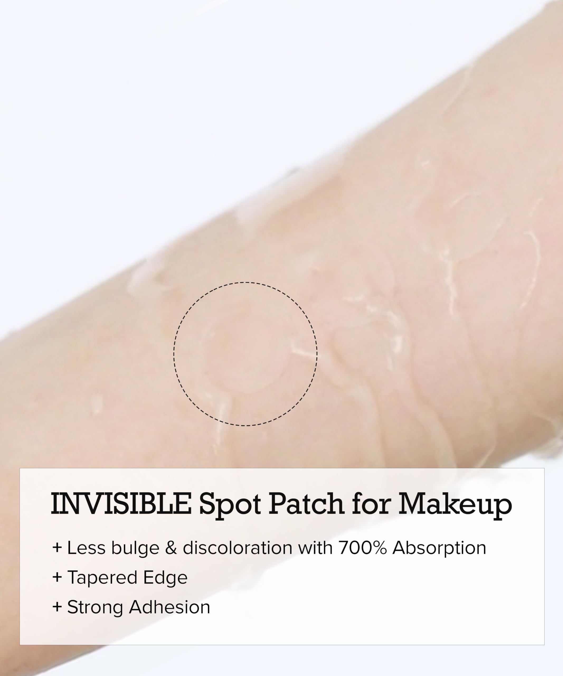 Pimple Lab pansement-adhesion-ferme: maintien fiable toute la journée