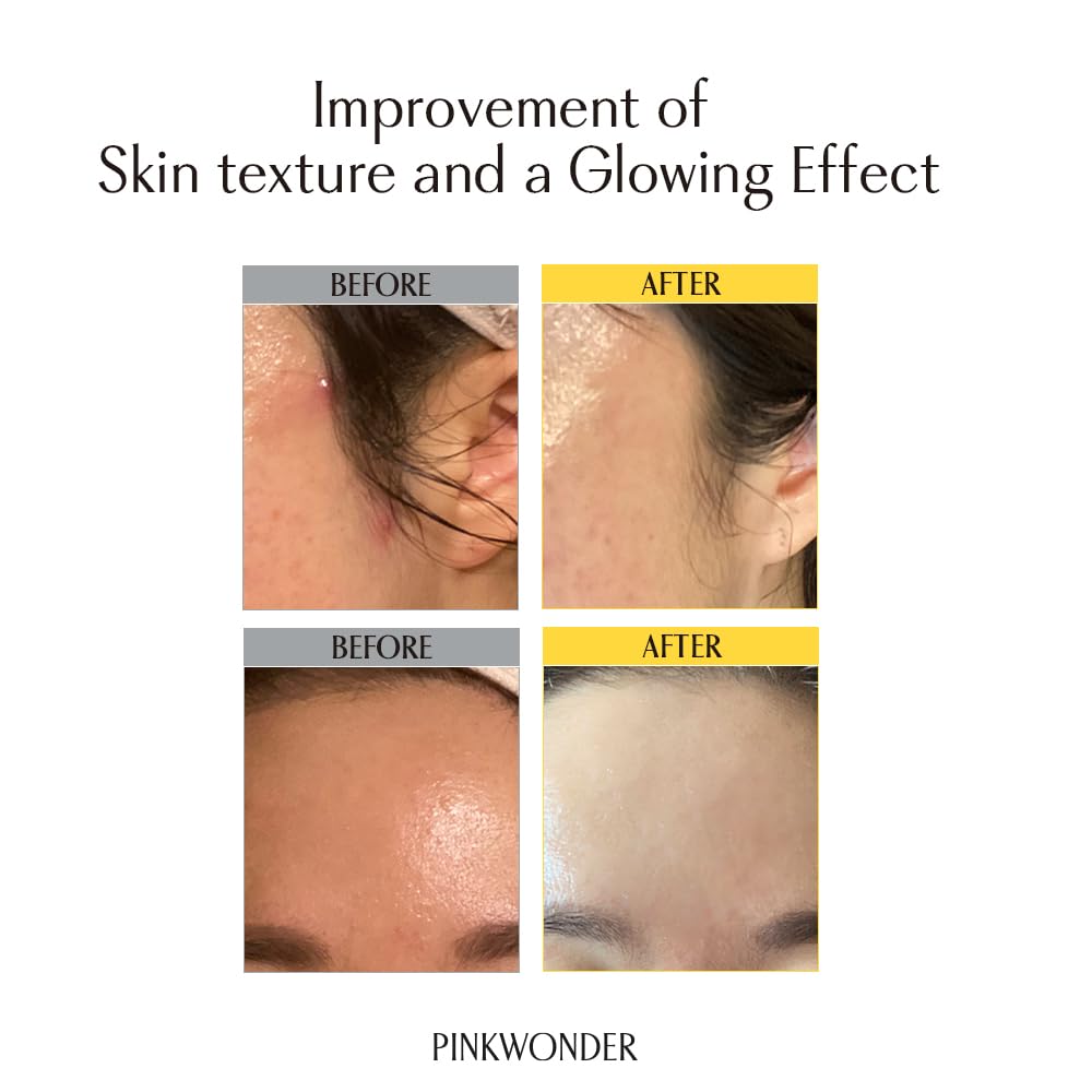 PINKWONDER Huile de jojoba bio pour outil gua sha, massage facial, fini soyeux.