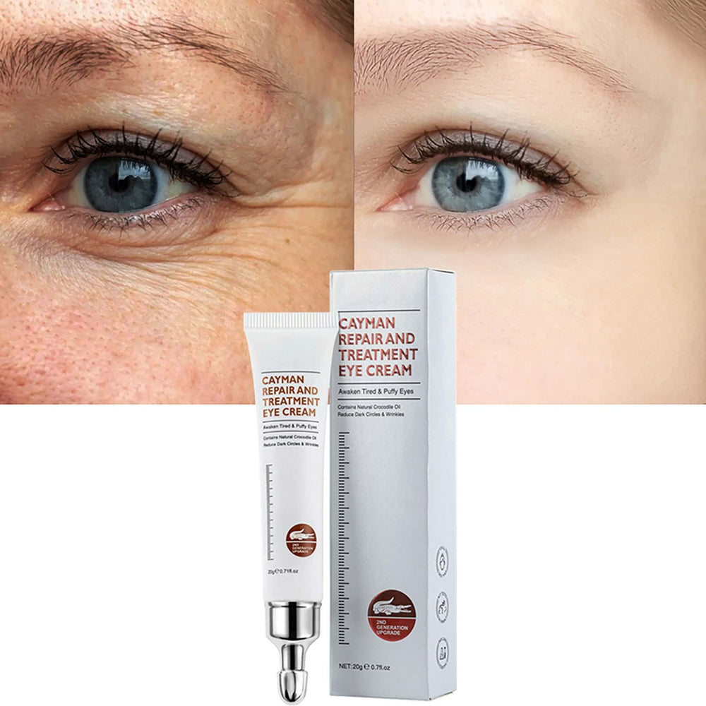 Pinnoocy crème yeux - Apaisement immédiat du contour et réduction des signes de fatigue.
