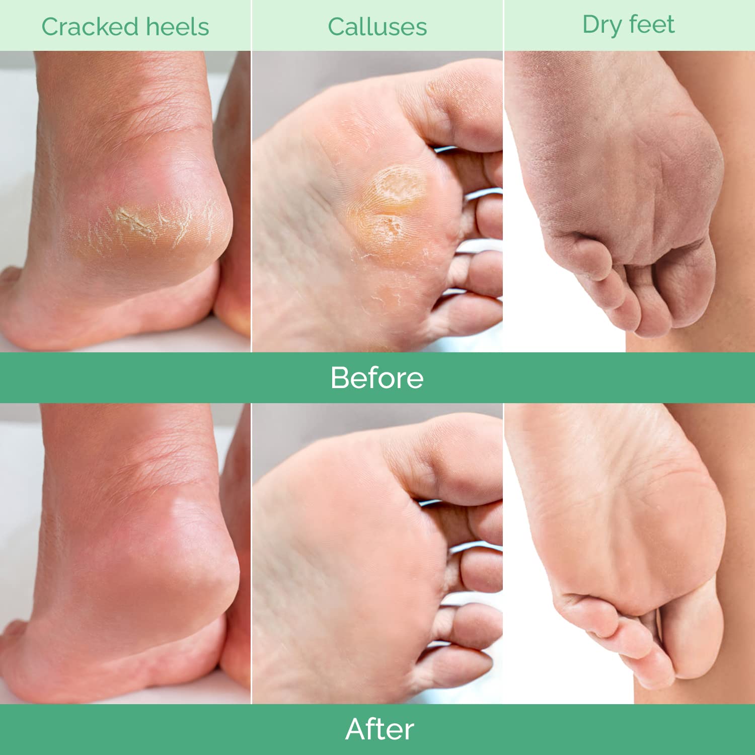 Plantifique application masque exfoliant pieds: étape rapide pour soins efficaces.
