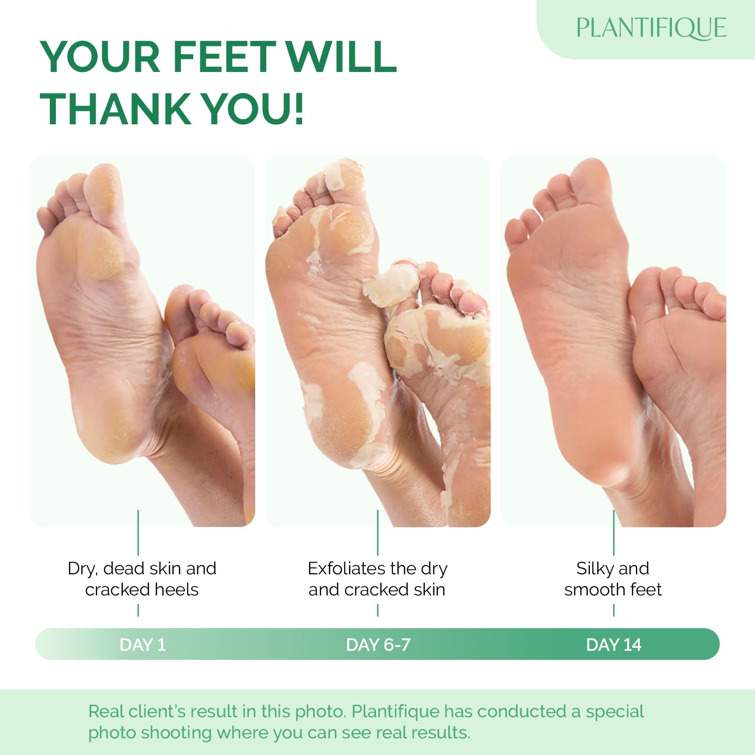 PLANTIFIQUE Masque Pied Peeling: sensation douce et pieds plus lisses apres usage