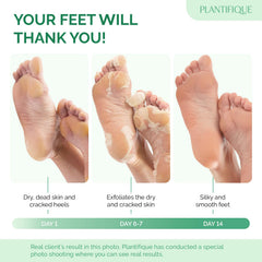 PLANTIFIQUE Masque Pied Peeling: sensation douce et pieds plus lisses apres usage