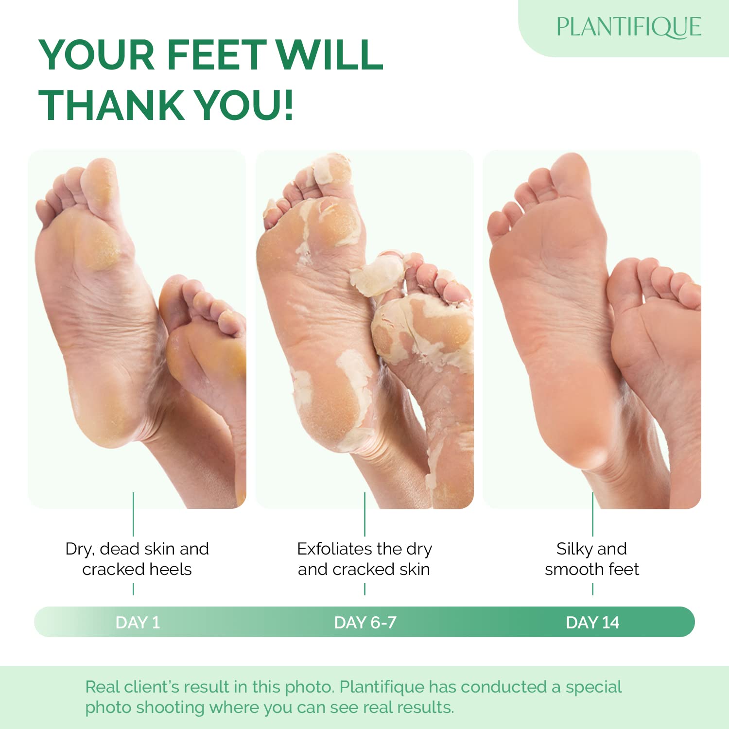 Masque-pieds talons doux Plantifique soulage les callosités