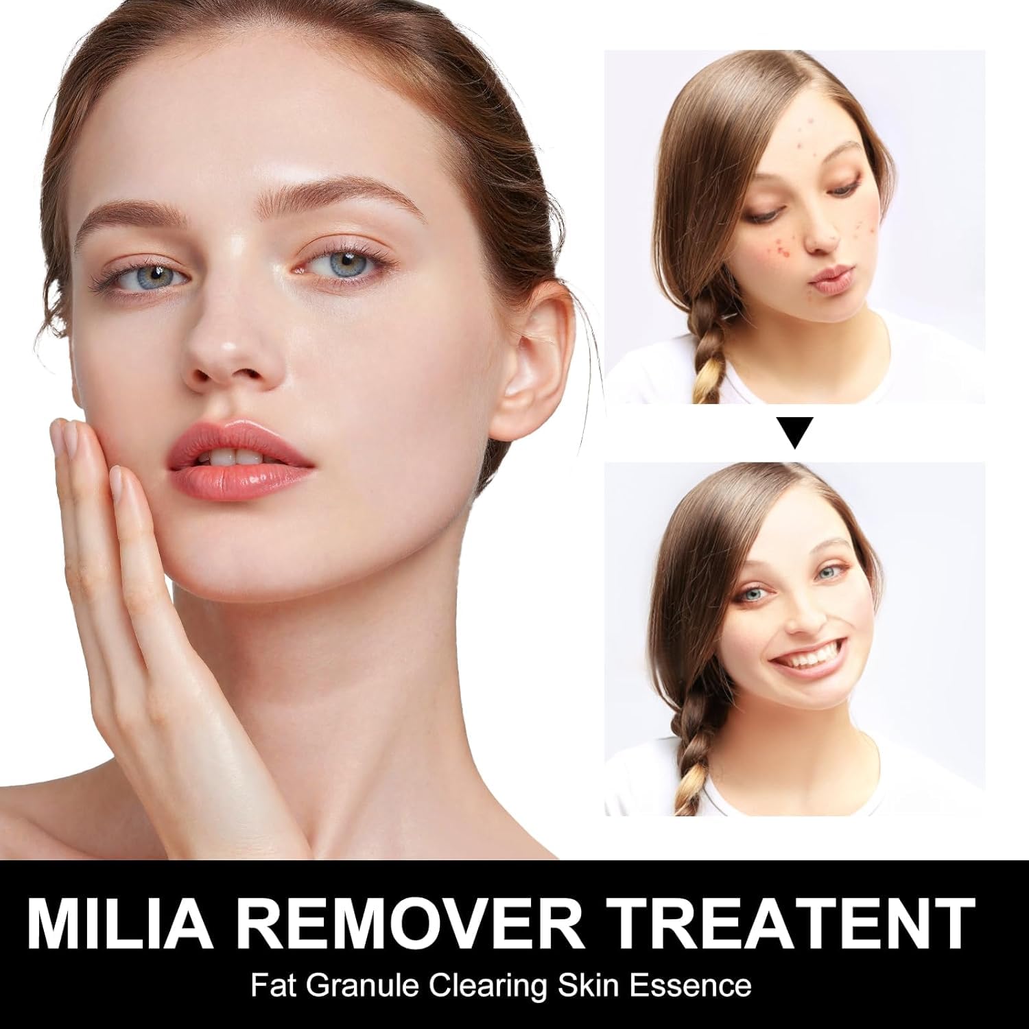 Platicat Milia Remover: application sur zones concernées, le sérum pénètre sans effort.