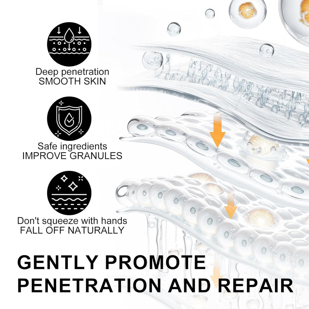 Platicat Milia Remover: soin visage ciblant imperfections pour peau homogène.