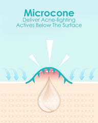 Plus1Herolabs acide salicylique — action douce pour peau sensible.