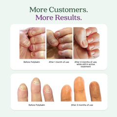 Texture naturelle et douce du baume Polybalm sur les ongles.