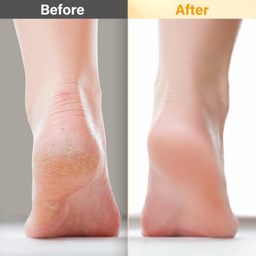 POP MODERN.C raspe pieds – outil précis pour lisser les callosités.