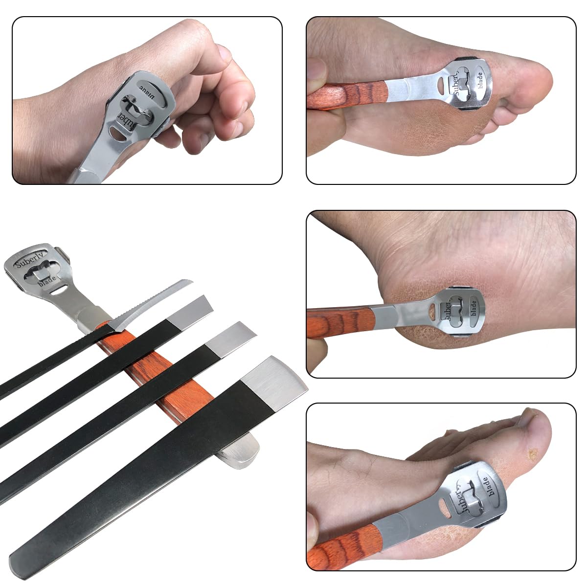 POQOD ensemble 36 pièces pour un kit pieds complet.