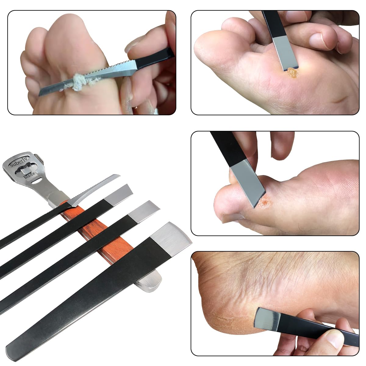 POQOD kit accessoires pieds de haute qualité pour un entretien régulier.