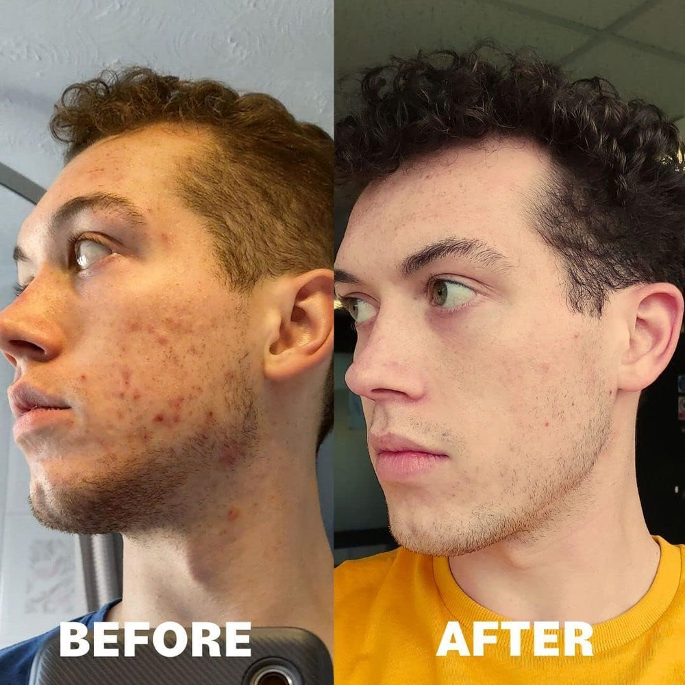 Pore Favor Complexe nutriments peau: soutien général et nourrissant.