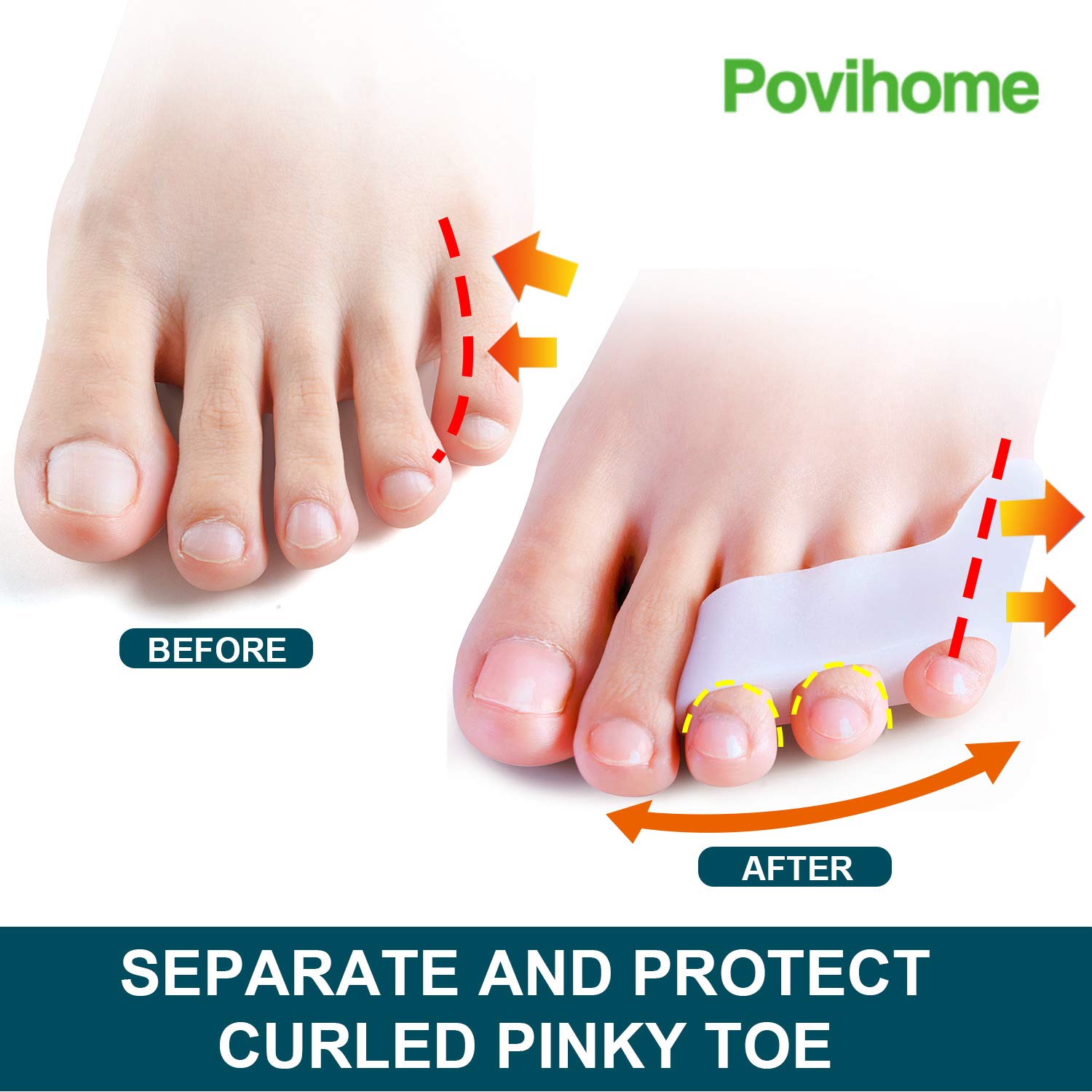 Povihome séparateur petit orteil à trois orifices maintien sûr