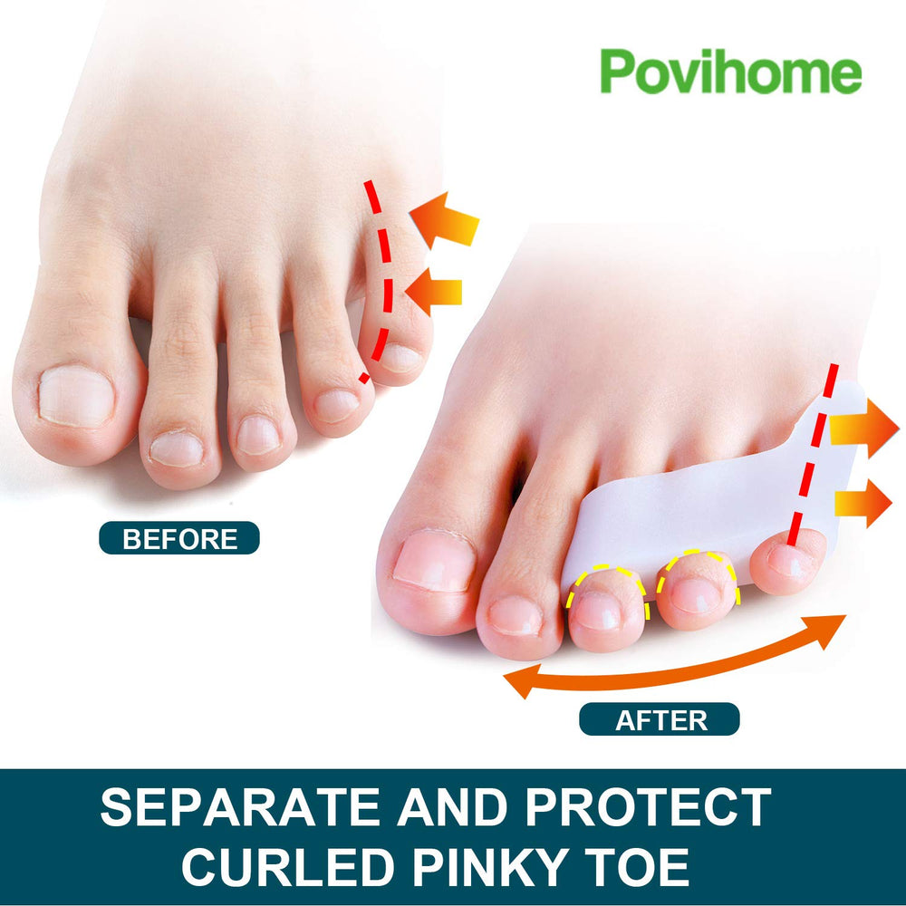 Povihome séparateur petit orteil à trois orifices maintien sûr