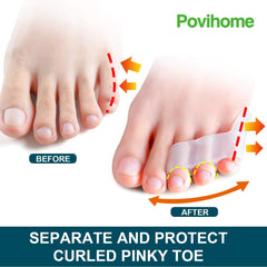 Povihome séparateurs d'orteils triple gel, favorisent l'alignement et le confort.