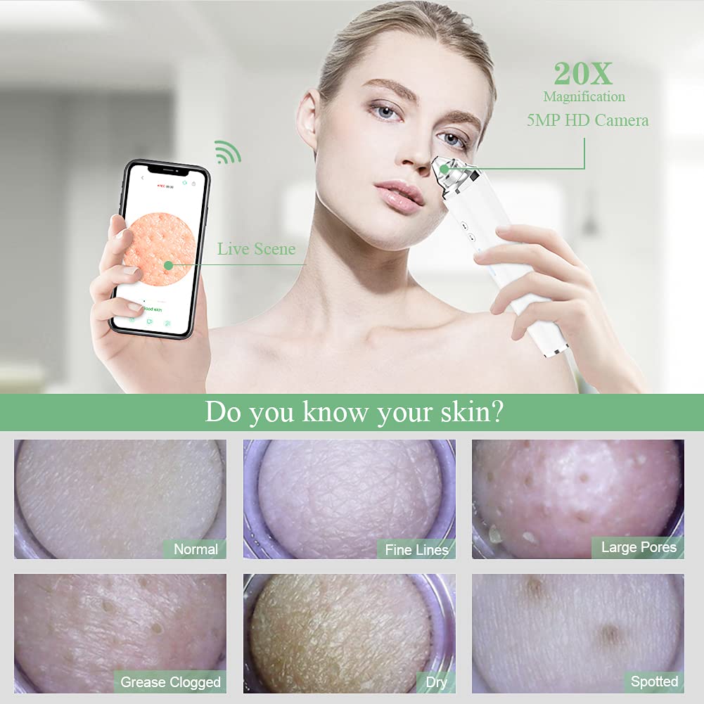 Prabensei aspirateur pores noirs avec WIFI, contrôle via smartphone pratique.