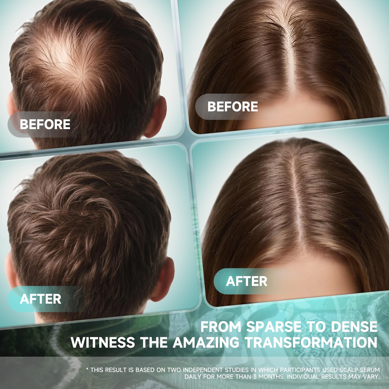 PRFTMK Sérum Biotine: renforcement de la fibre capillaire