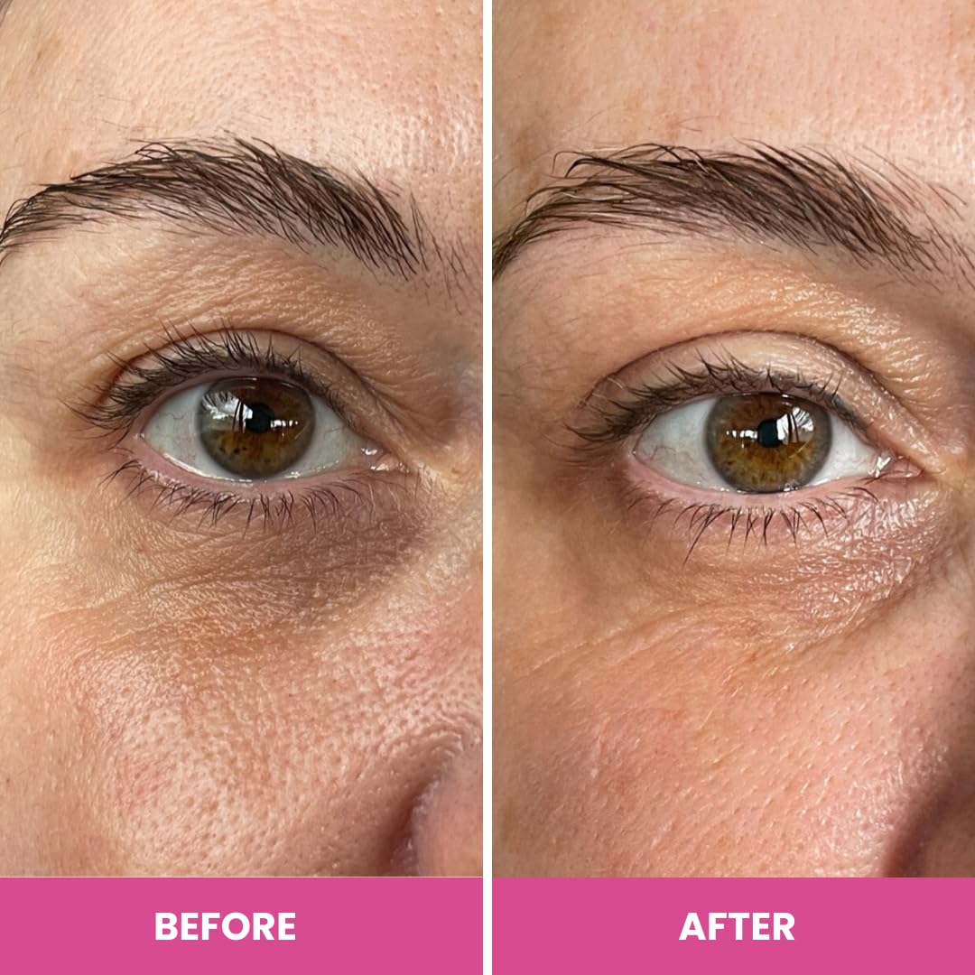 PrimeEyes Hydrate – 5-peptides: formule synergique pour une peau mature plus fermée.