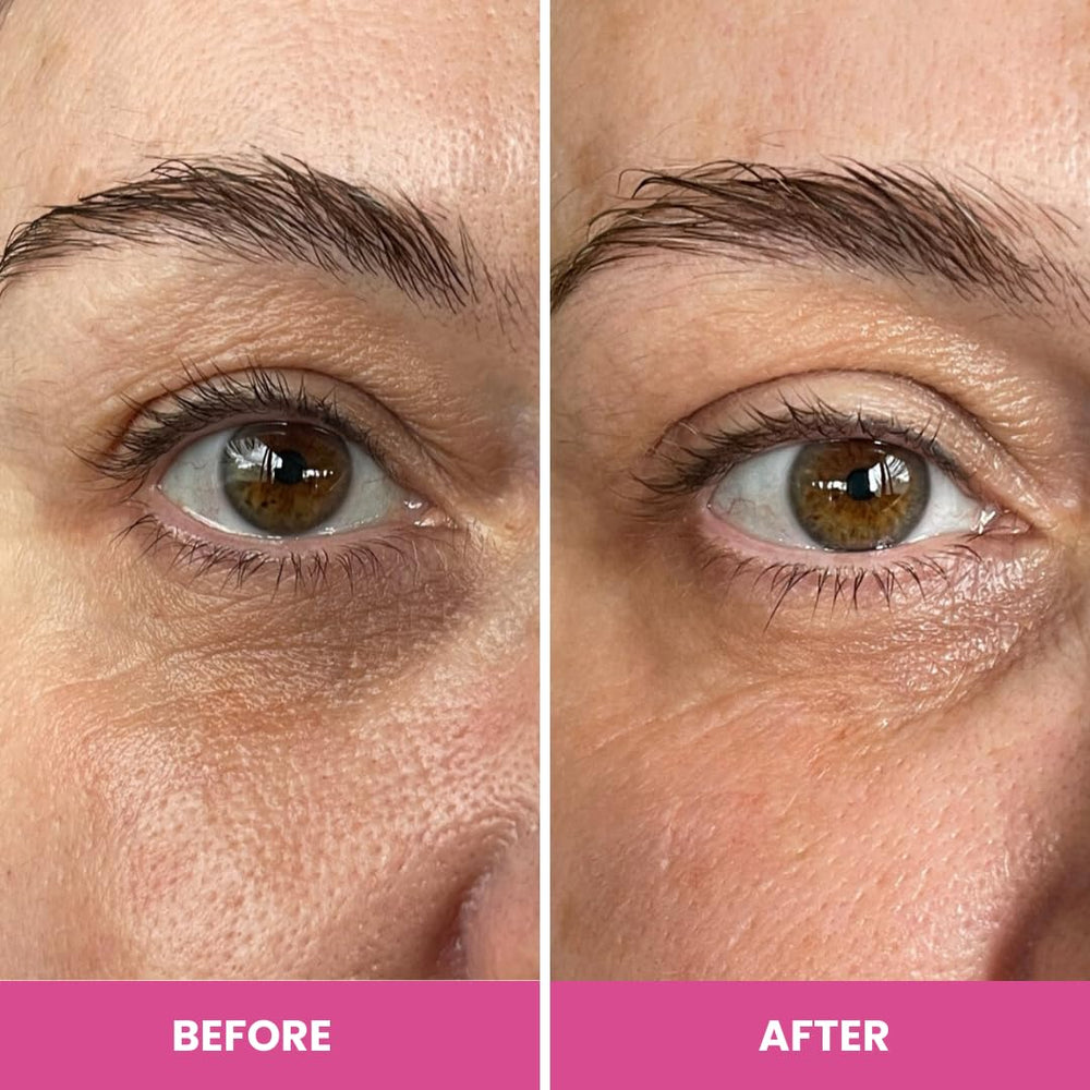 PrimeEyes Hydrate – 5-peptides: formule synergique pour une peau mature plus fermée.