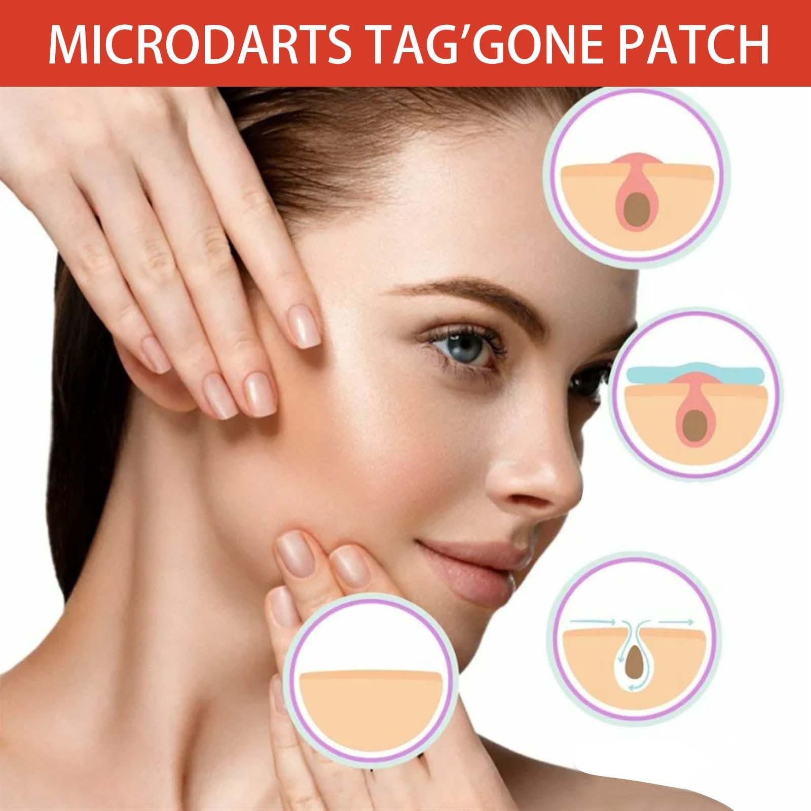 Patch Pro Microdarts application nocturne pour apaiser les irritations