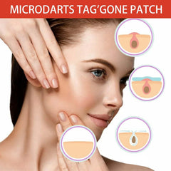 Patch Pro Microdarts application nocturne pour apaiser les irritations