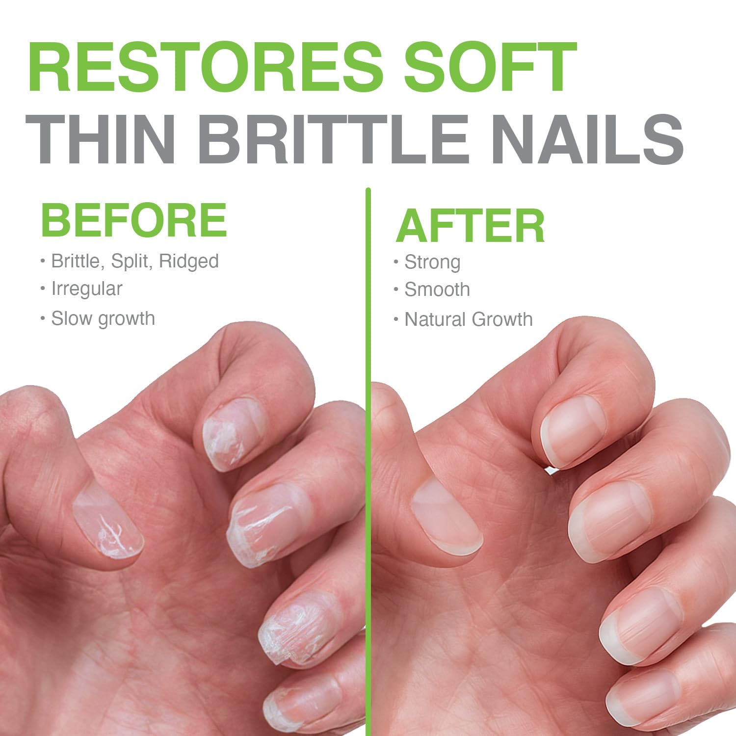 Probelle Renforçant d’Ongles Formule 1 — couche-base pour structurer l’ongle fragile.