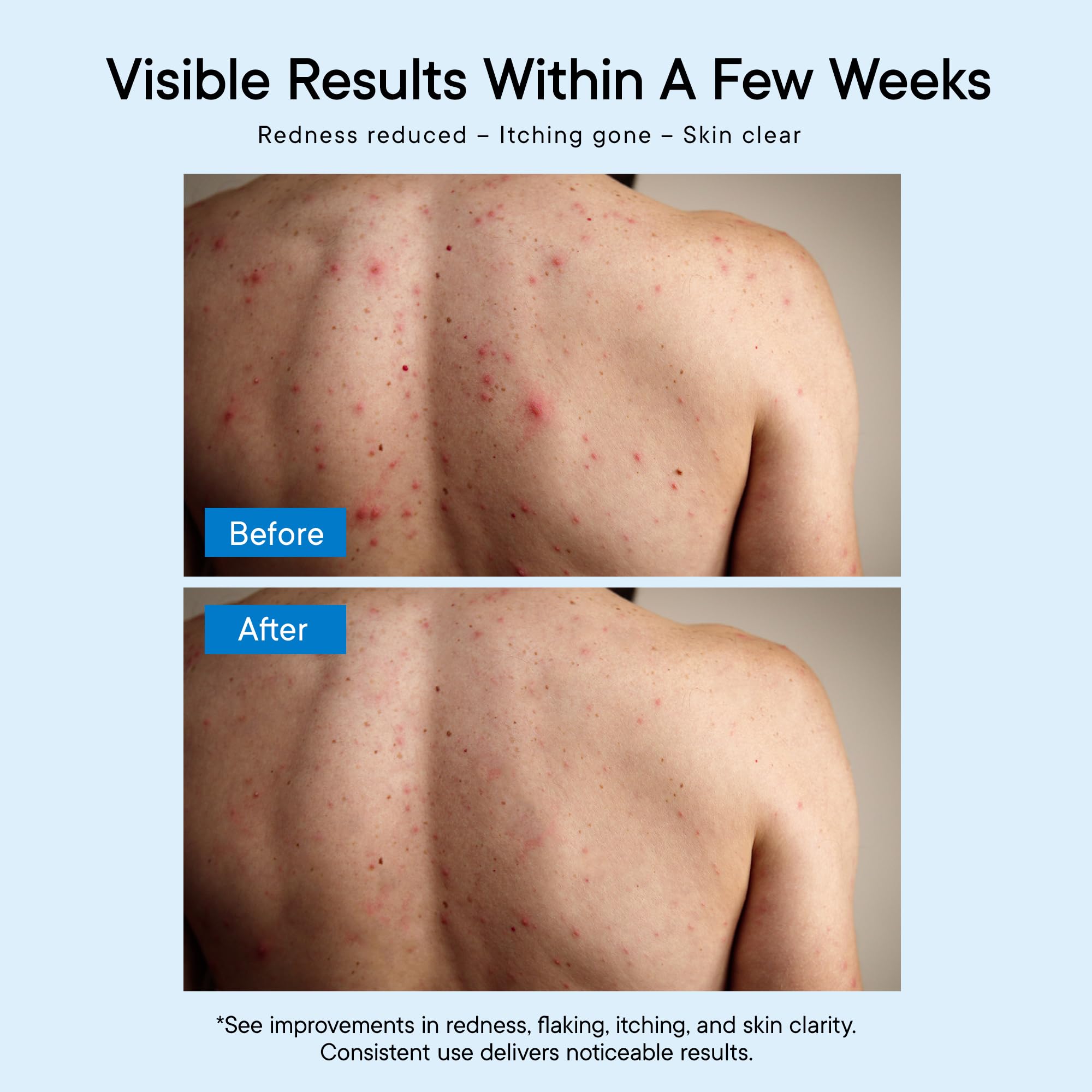 ProBliva: texture mentholée visible pour une sensation de fraîcheur sur la peau.