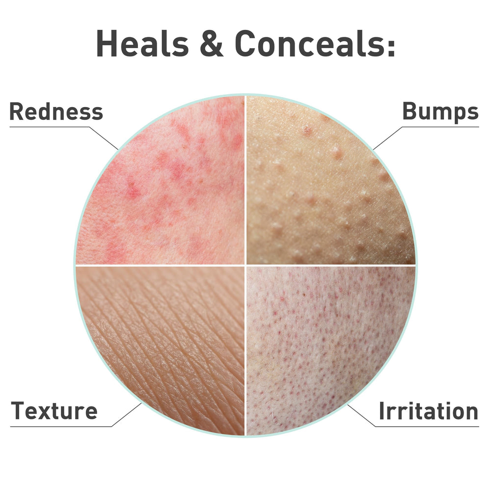 PROcure Rosacare Masque Feuille Ingrédients naturels pour peau saine.