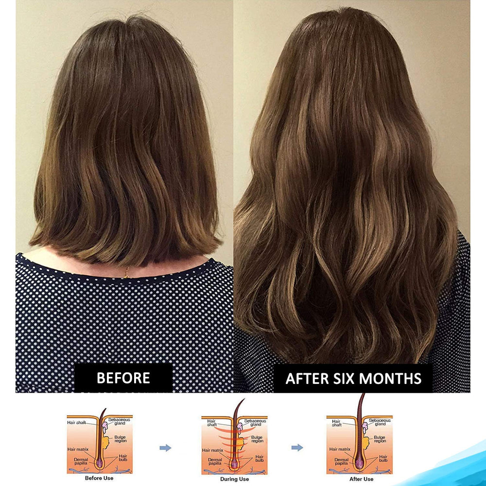 Pronexa Hairgenics Shampoing – Vue d'ensemble, action potentielle contre la perte.