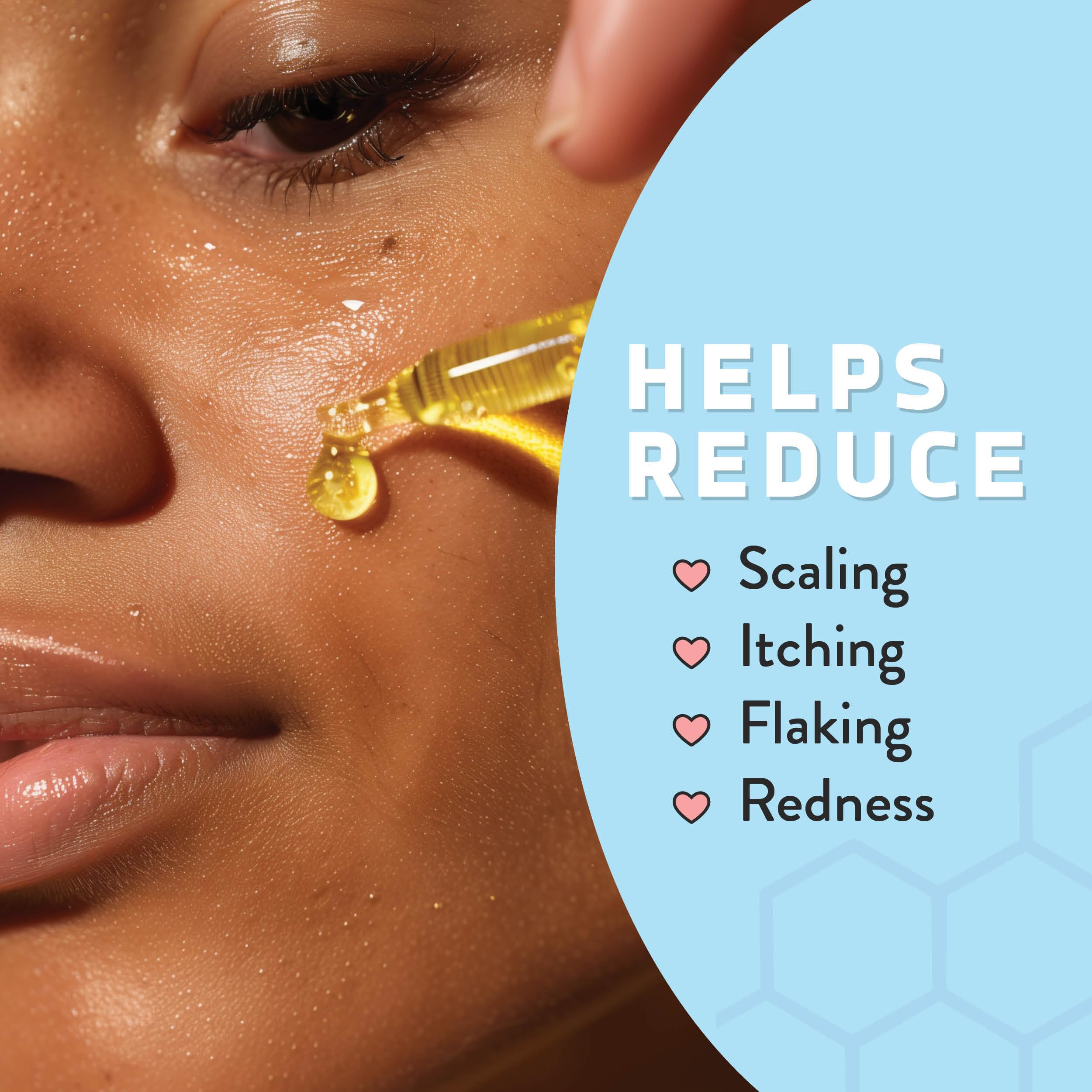 Sérum Psoriasis Honey, absorption rapide pour usage quotidien sans gras.