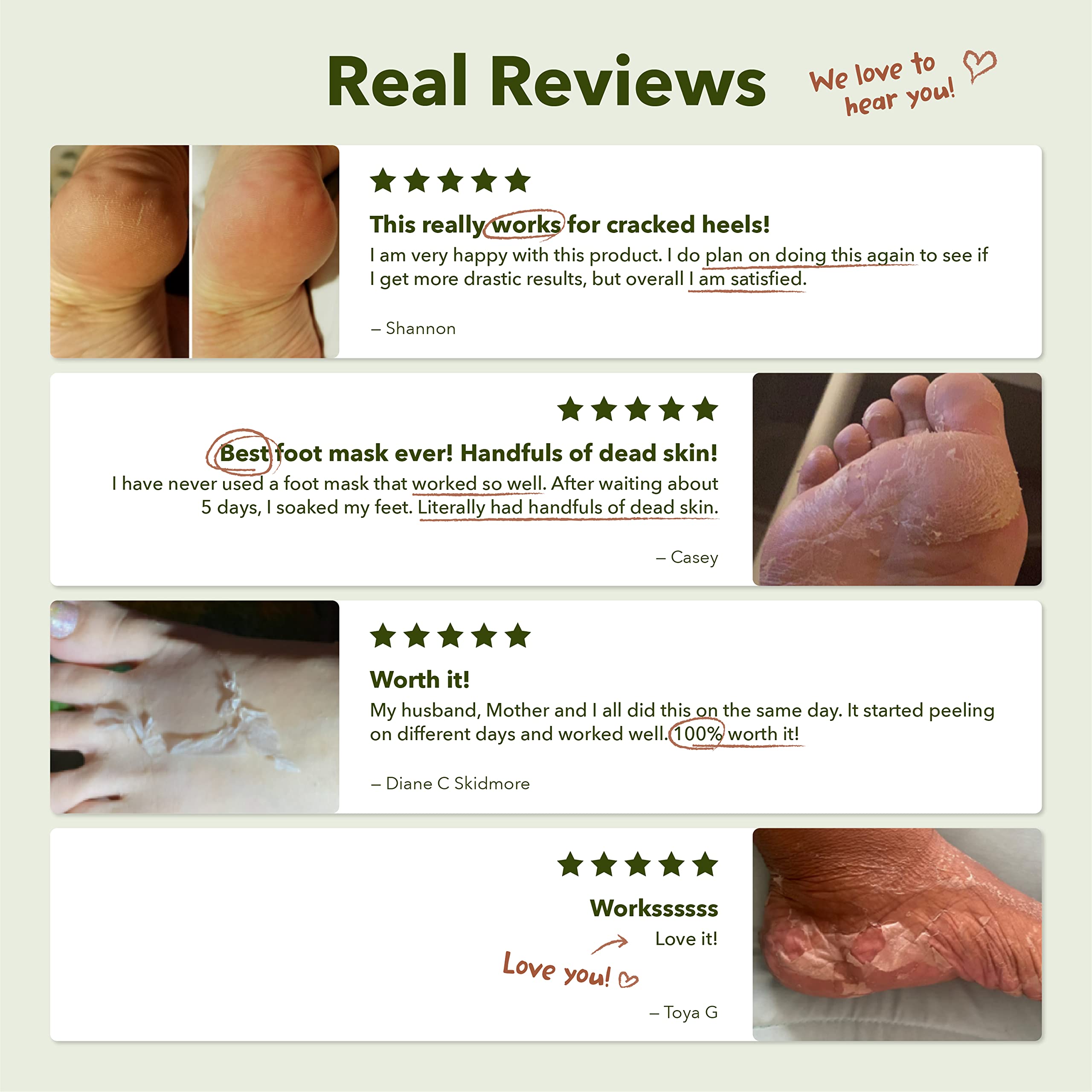 Purederm before and after view highlights heel improvement