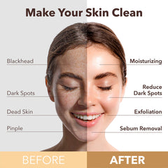 Purederm bulles oxygene – bulles visibles sur le masque, revitalisent la peau.