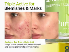 PURITO Azelaic Acid 10% dropper for precise dosing and targeted acne control.