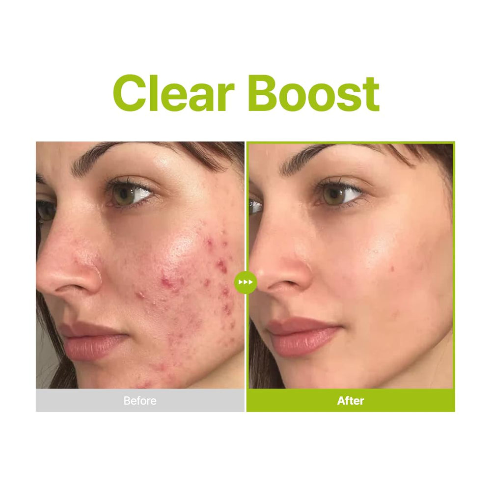 PURITO Azelaic Acid 10% packaging box presenting premium skincare packaging.